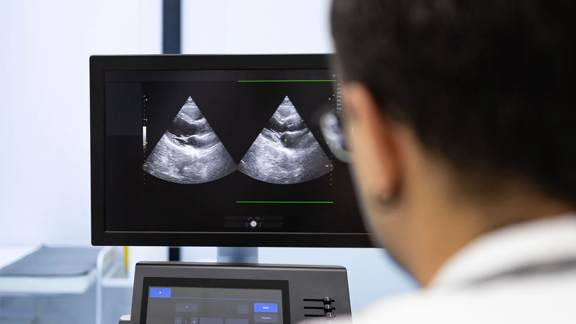 ECU-developed AI to revolutionise early disease detection